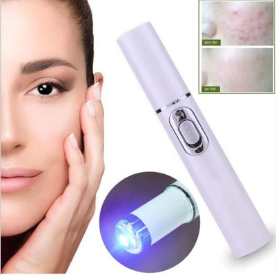 Portable acne laser pen for wrinkle removal using blue light therapy on skin.