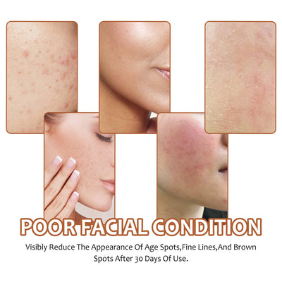 Lemon turmeric kojic acid soap reducing age spots, fine lines, and brown spots on facial skin after 30 days use
